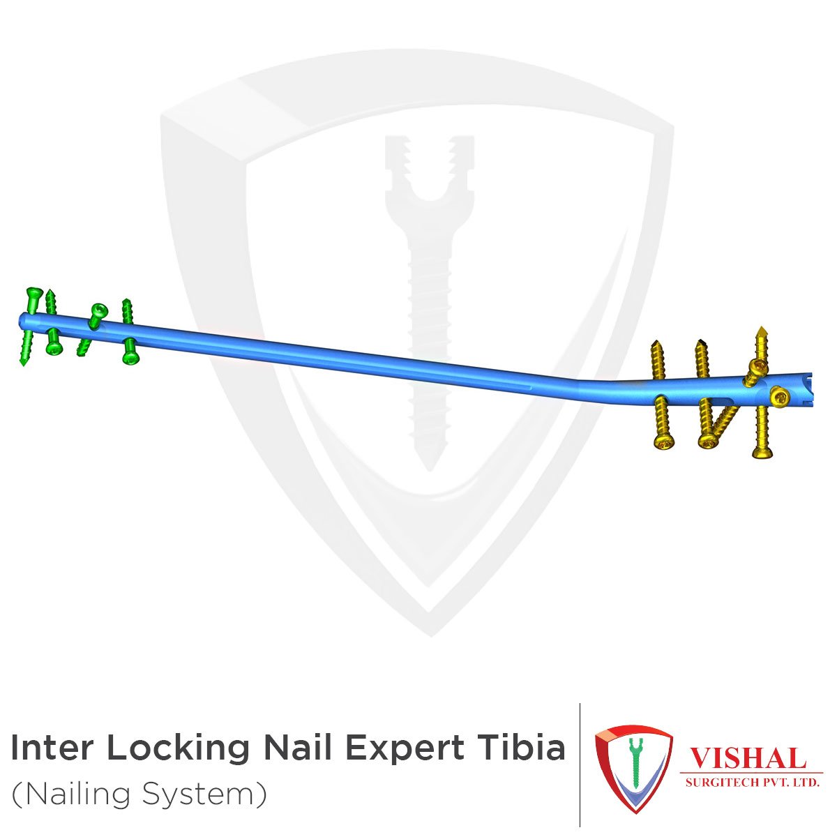 VishalSurgitech's tweet image. Inter Locking Nail Expert Tibia:

Size: od 8, 9, 10, 11mm
Length: 280mm to 400mm with 10mm variation

#VishalSurgitech #NailingSystem #Tibia