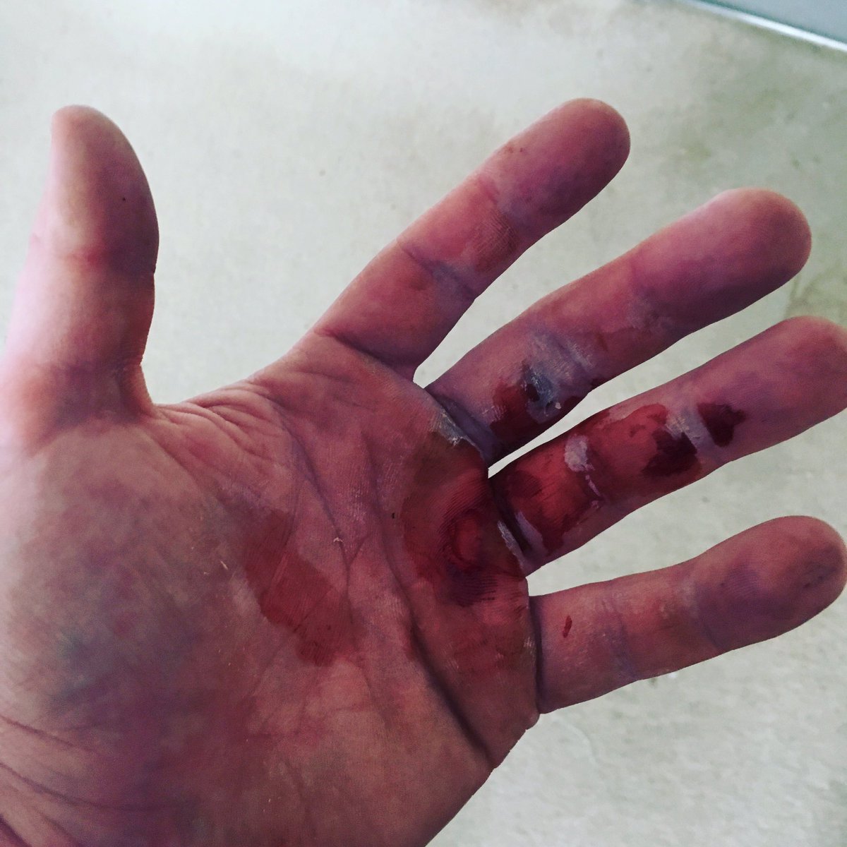 danbarkerpt's tweet photo. Result of today's conditioning session @TrainManchester. Good job I have a few days off, now time to eat!
#poorlyhand #12daysoffitness https://t.co/jc8ekUyRpm