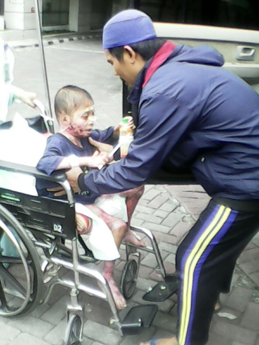 SunnahKu's tweet photo. Ismail (5, Luka Bakar) diantar pulang menuju Purworejo. #SRJogja @SRbergerak https://t.co/ENQq9vKY2Z