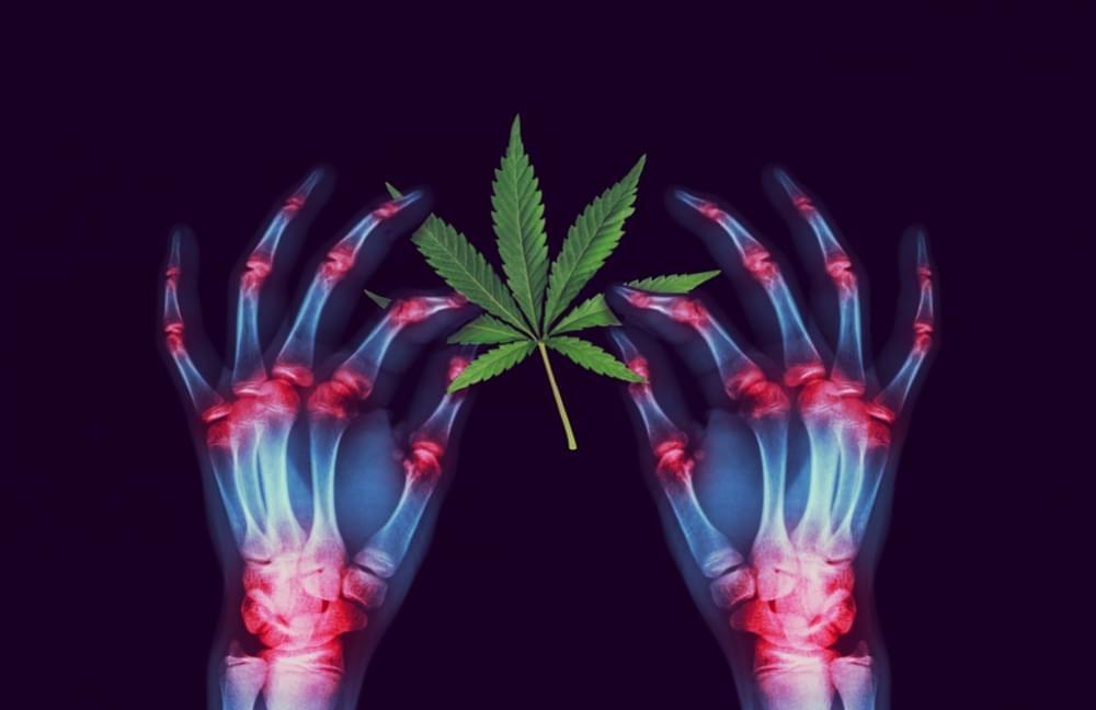 #GoodNews The Arthritis Society Funds Medical #Cannabis Research For Fibromyalgia arthritis.ca/news-and-media…