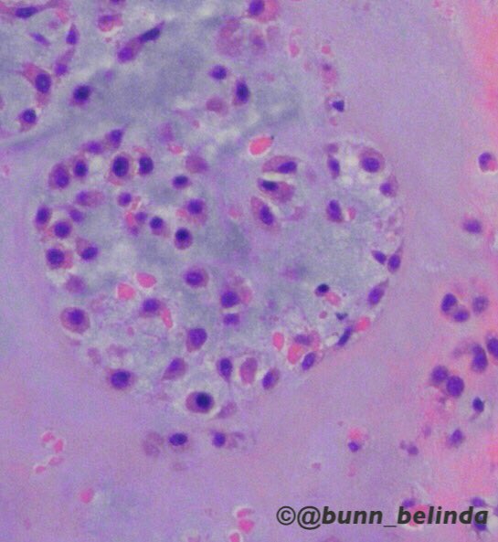 bunn_belinda's tweet photo. Merry Christmas, Season's Greetings & Happy Holidays to all my Pathology friends on Twitter! :))ππβ¨πΎπ¬ #pathology #pathart (#pathHeart π¬ππ¬) https://t.co/EggN43fRBX