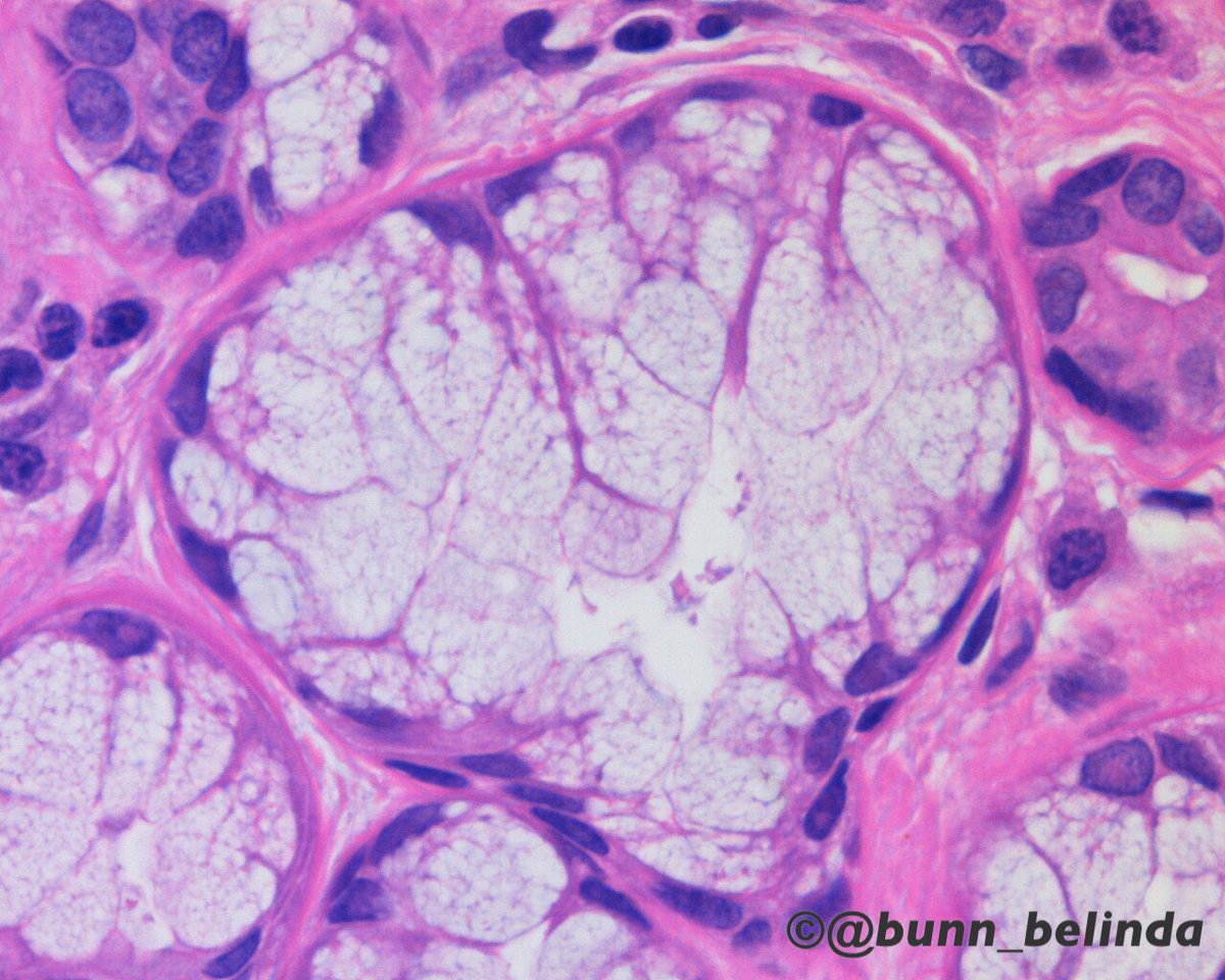 bunn_belinda's tweet photo. Merry Christmas, Season's Greetings & Happy Holidays to all my Pathology friends on Twitter! :))ππβ¨πΎπ¬ #pathology #pathart (#pathHeart π¬ππ¬) https://t.co/EggN43fRBX