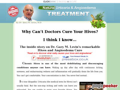 Pure Urticaria (Hives) &amp; Angioedema Remedy By Dr. Gary M Levin Hives Urticaria &amp; Angioedema Remedy System | Remedy &amp; Aid   http