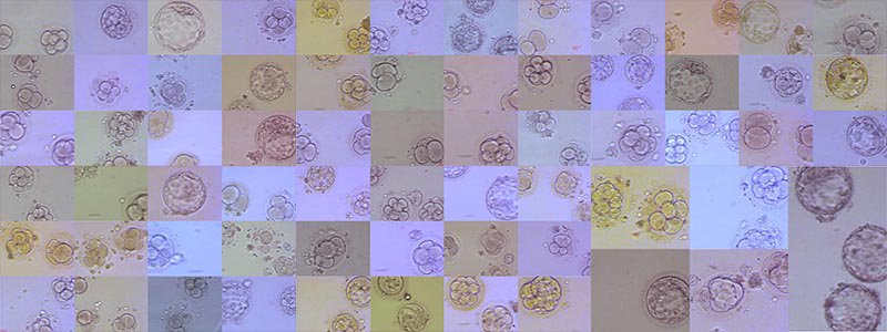 GyneInVitro's tweet photo. 49.6% klinische Schwangerschaften im Jahr 2016 in unserer neuen Tagesklinik Gyné invitro - siehe Blog https://t.co/BIjUtpkPho https://t.co/2G6e4C37a5