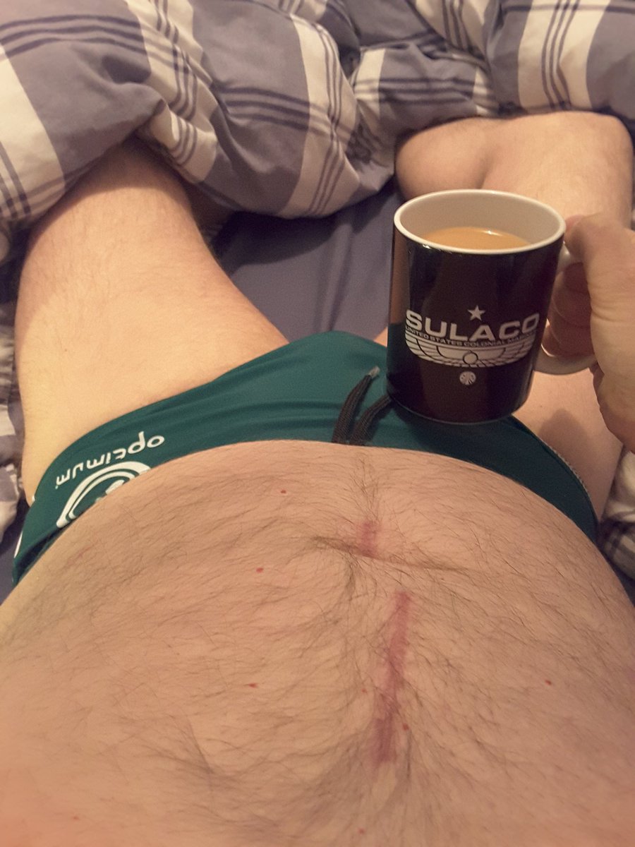 RugbySmut's tweet photo. Boxing Day #Teacupping rugger Speedos, Alien geek mug and something for the scar fetishists https://t.co/qeCipldzLN
