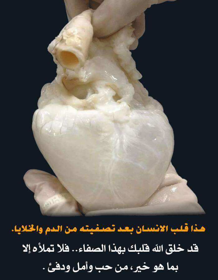 MMansourf16's tweet photo. https://t.co/AbFBcgN0Sb