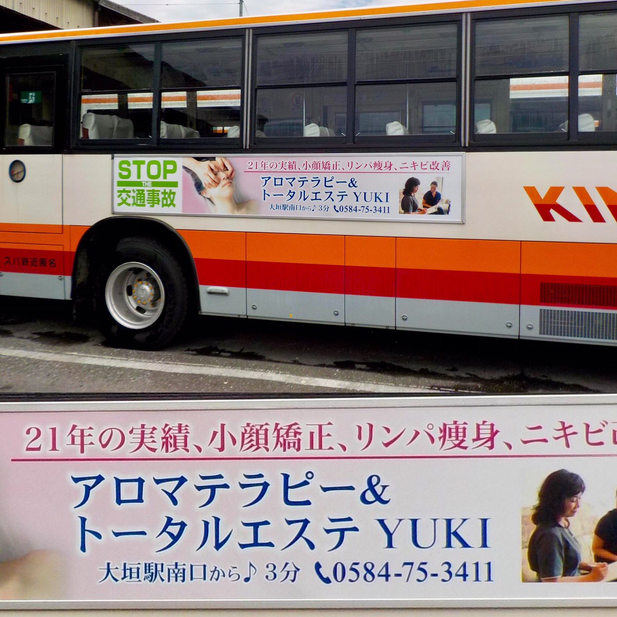 頬骨の出っ張り 頬骨の出っ張り