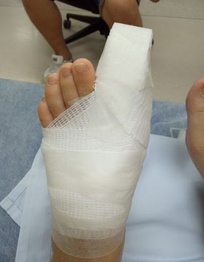 เตือนภัย ร้านอาหารทะเลแถวบางปู อ่างล้างหน้าห้องน้ำตกใส่เท้าลูกค้าจนกระดูกร้าว pantip.com/topic/35955934…