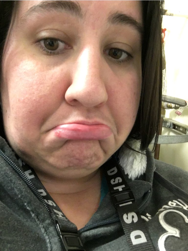 tarataterbeans's tweet photo. Well someone gave me a sinus infection & cold sore for Christmas, does that count as a gift? #SFGExchange @SFGiants https://t.co/3sS6c5xnCM