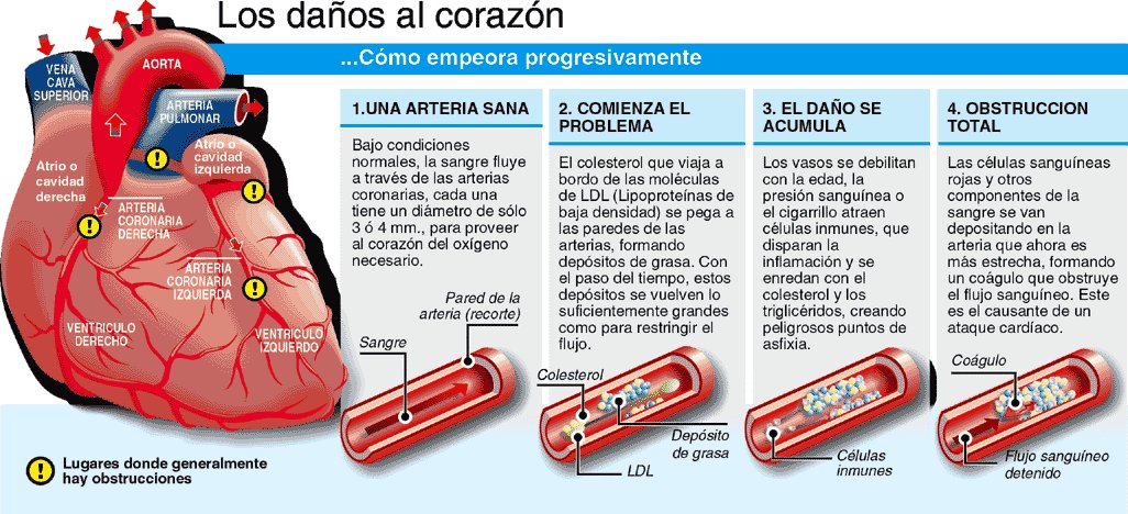 Trigliceridos altos consecuencias