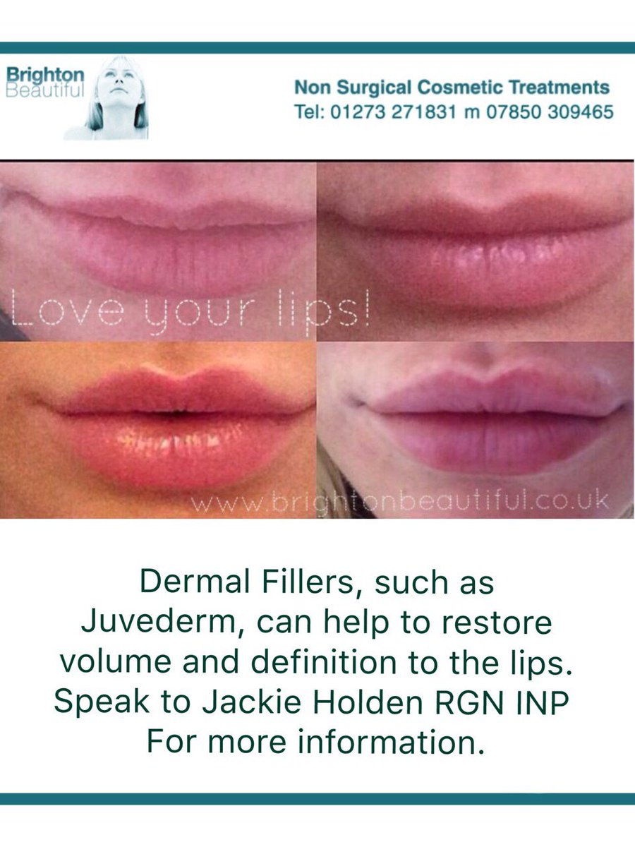 BtonBeautiful's tweet photo. Looking for natural-looking, fuller lips in 2017? Come to Brighton Beautiful: https://t.co/HQ1AGNyQvI https://t.co/XWP2doMvXr