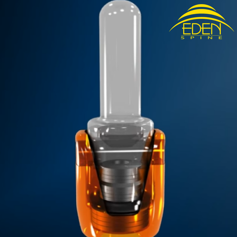 EdenSpine's tweet photo. Our Perfx-2 #technology allows #surgeons to create a dynamically instrumented transitional zone. https://t.co/BaFMumHSor https://t.co/NOwdfsGvta