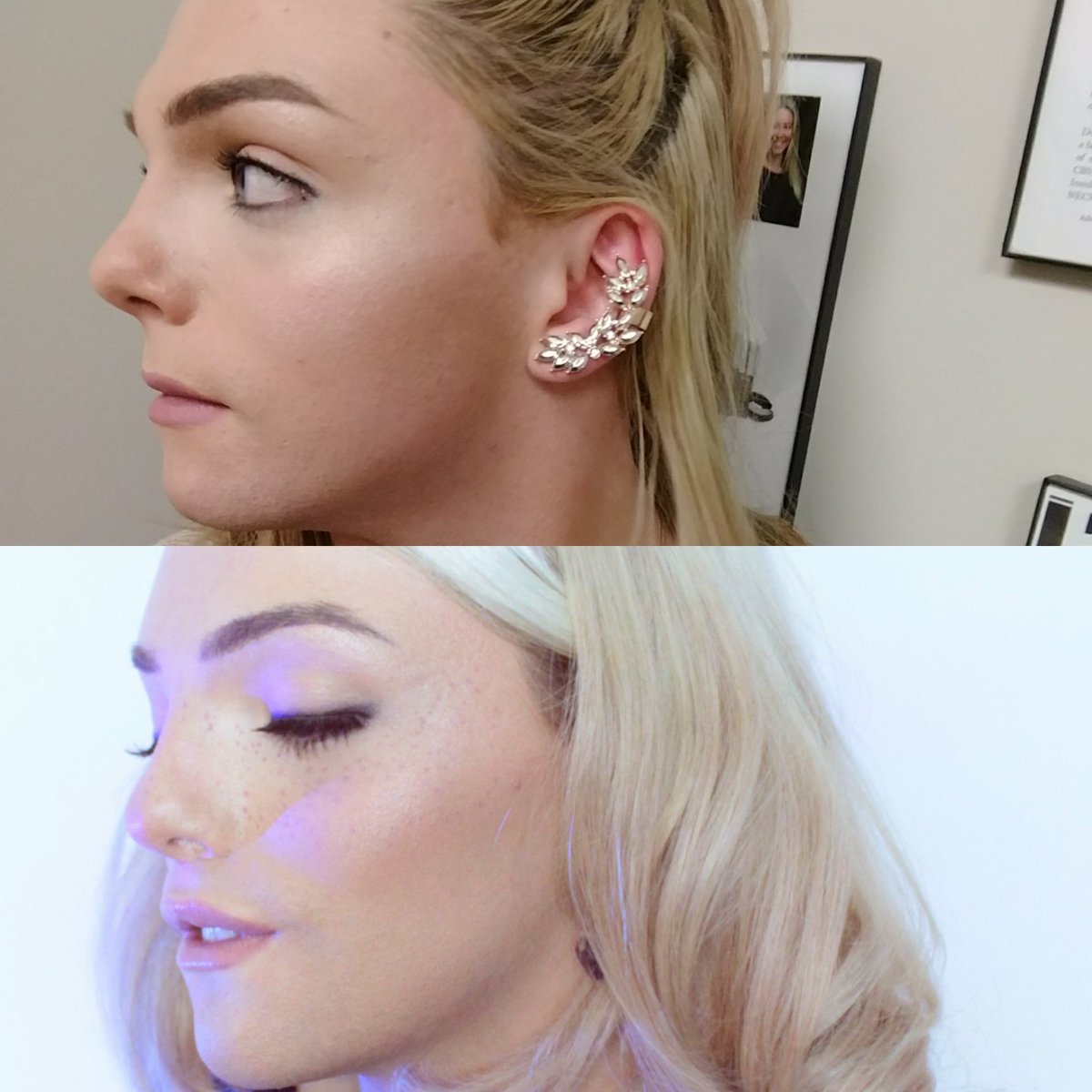 Facial feminization photos and testimonials, exciting free hq porn pics