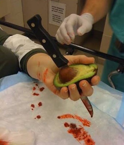 paginamedicinae's tweet photo. Cuidado ao cortar o abacate! 😱🔪 https://t.co/F9yArs3C8x