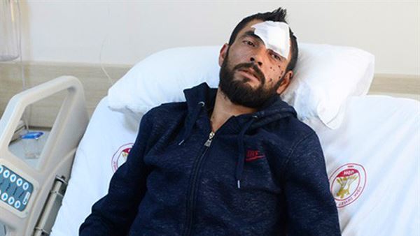 donanimhaber's tweet photo. Uşak’ta ucuz powerbank patladı: Kullanıcı kalbinden ağır yaralandı https://t.co/iZskGmspwS https://t.co/QtUwt0sYaE