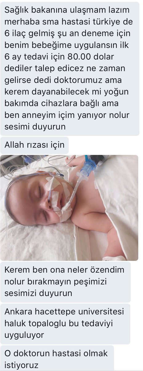 izmirdecevirmee's tweet photo. Minik Kerem'in bir an önce ameliyat olması lazım.Su anda Ege Üniversitesinde.. Annesinin yazdığını mutlaka okuyun ve paylaşın arkadaşlar https://t.co/wt7WbGoAj1