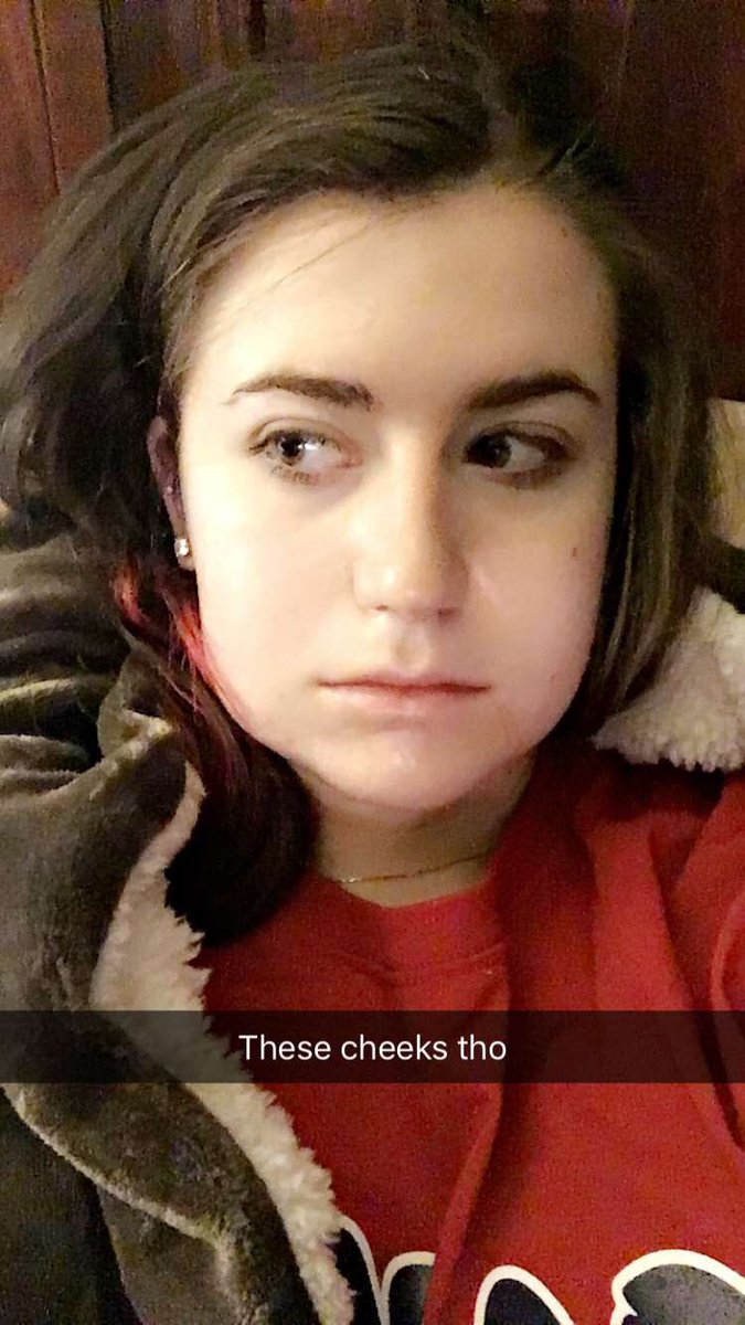 BonnerLBlack's tweet photo. Got my wisdom teeth taken out last night. #hotgirl #eyecandy https://t.co/wmHorszGji