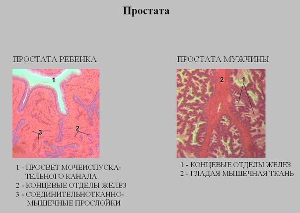 Простата у мужчин это простыми словами. Гистологический препарат предстательной железы. Предстательная железа гистология препарат. Предстательная железа ребенка гистология препарат. Концевые отделы желез гистология.