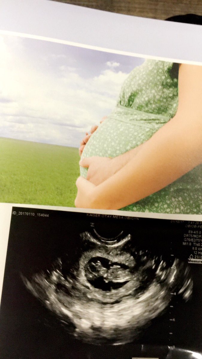 Couldn't have asked for a better blessing 🙏❤️👶🏻