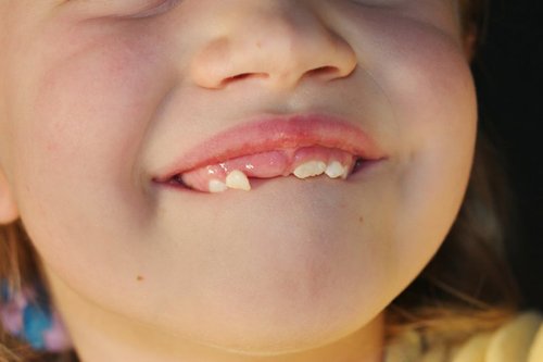 KitchenerGroup's tweet image. Tooth-fairy customs from across the globe: goo.gl/nbHMt2
#ToothFairy