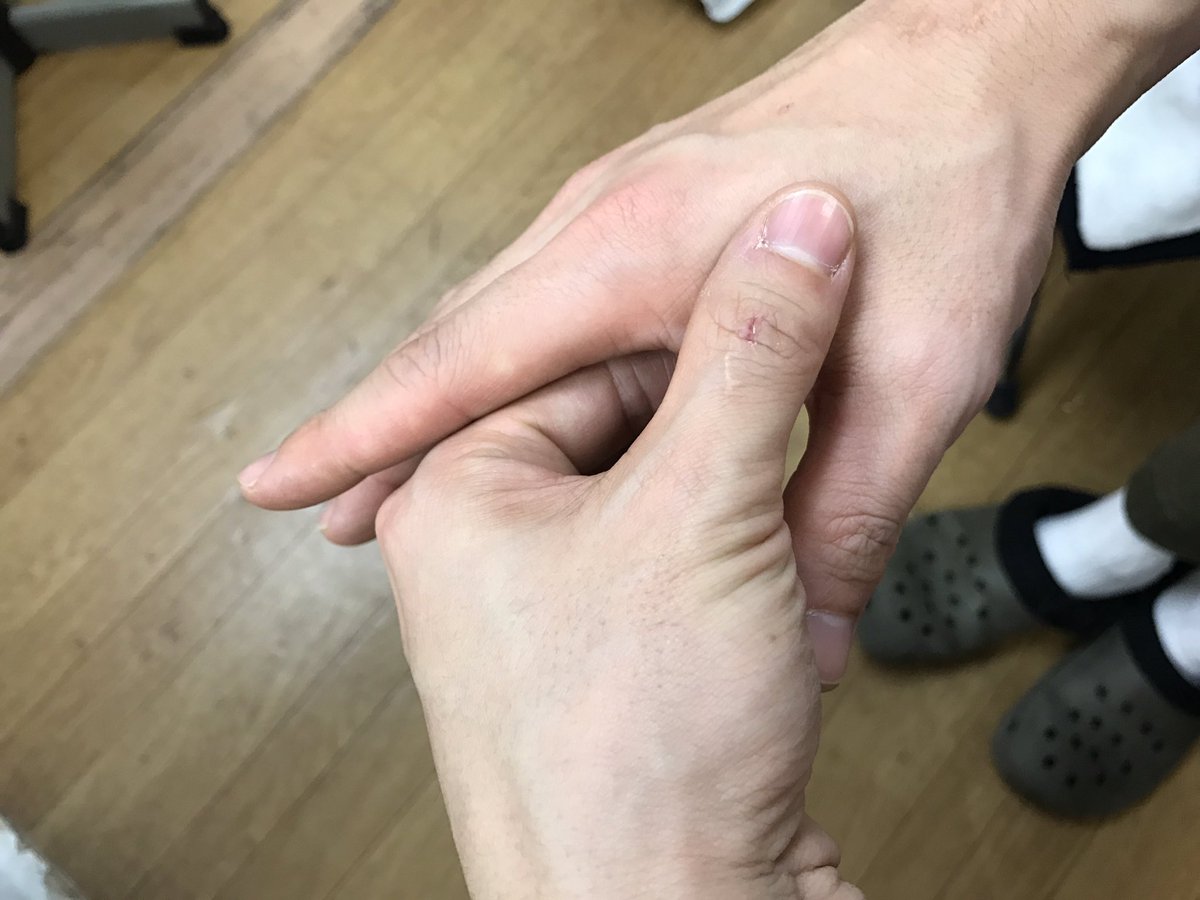 Coco美漢方 田中 友也 ごほうび漢方 絶賛発売 万能のツボ 合谷 場所 親指と人差し指の骨が合わさる辺りでジーンと痛みのある所 押し方 グーっと3秒押して離すを繰り返す または 指圧したままグルグル回すように押す 合谷は頭痛 肩こり Coco美漢方 田中 友也 ごほうび漢方 絶賛発売 万能のツボ 合谷 場所 親指と人差し指の骨が合わさる辺りでジーンと痛みのある所 押し方 グーっと3秒押して離すを繰り返す または 指圧したままグルグル回すように押す 合谷は頭痛 肩こり