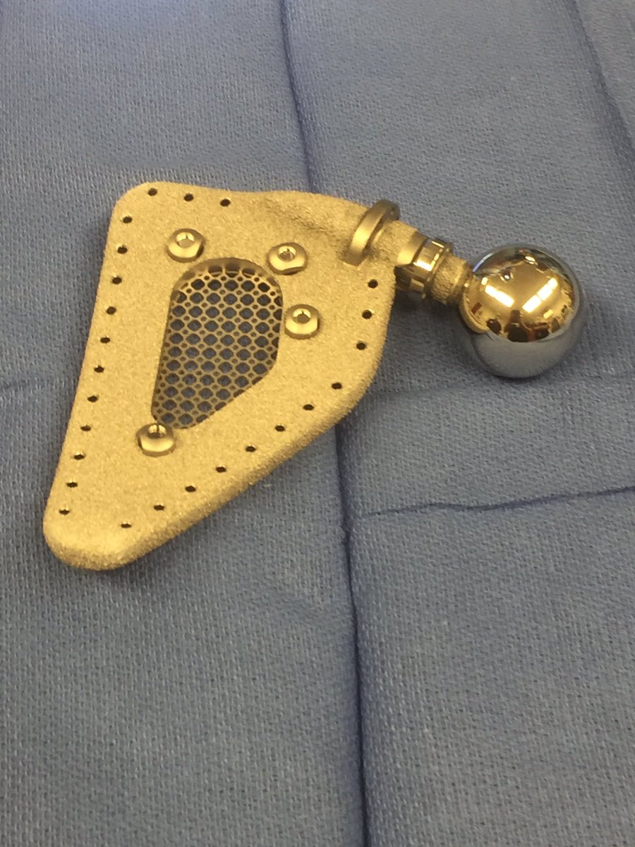 SarcomaCenter's tweet photo. Using custom designed bones and joint replacements, we provide innovative reconstruction options for sarcoma patients #bonecancer #kumed https://t.co/qXG1t9TvRu