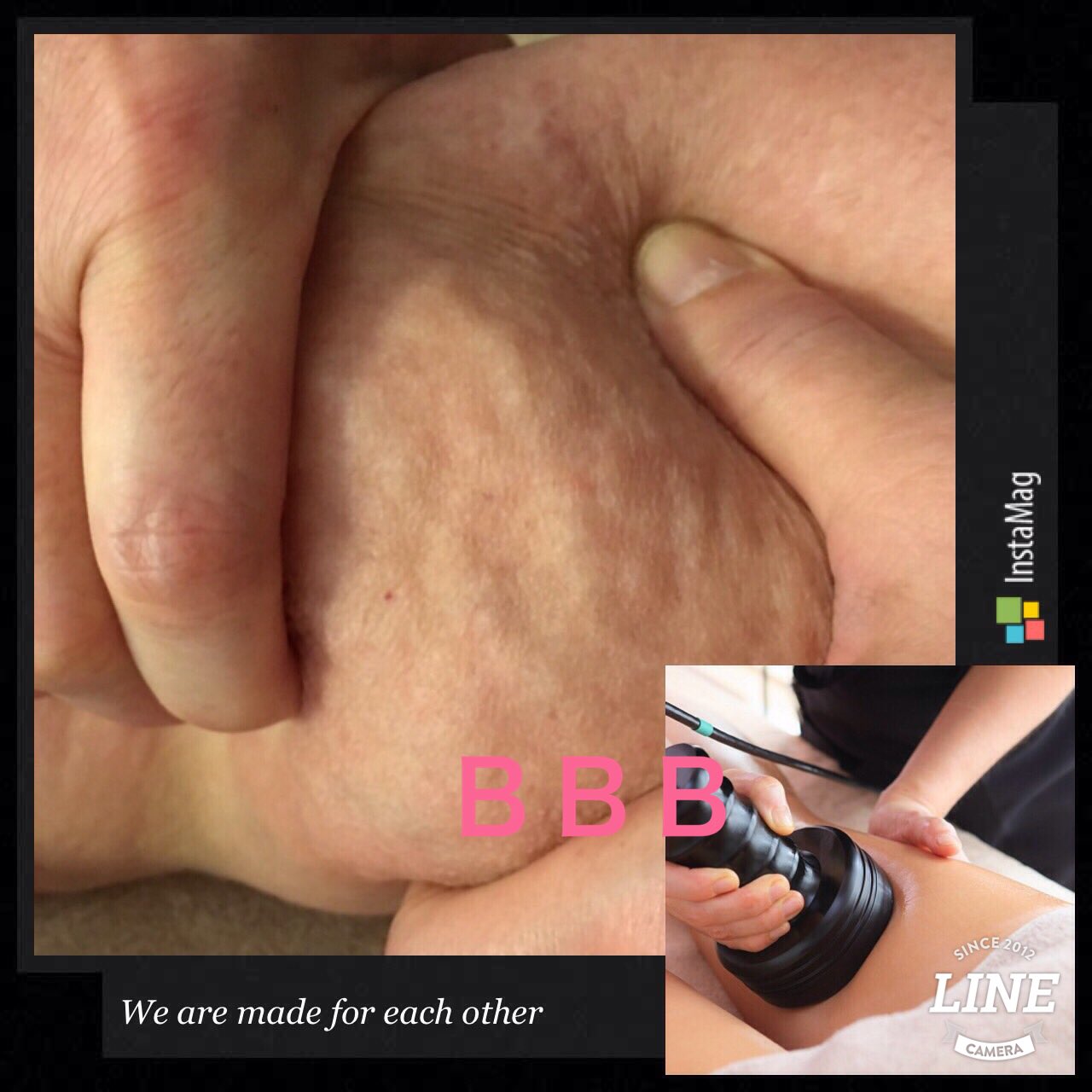 セルライト av salon BarBieBody (@salonBarBieBody) / X