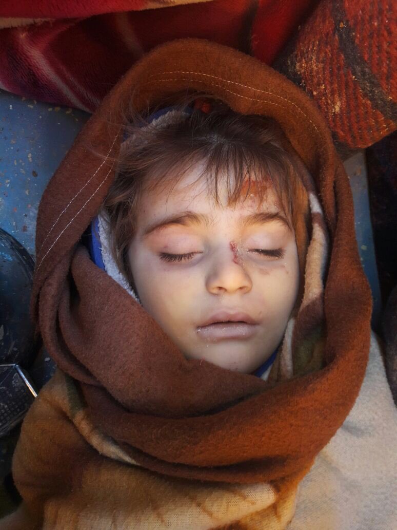 Magedabdelnour1's tweet photo. مجزرة شنيعة في قرية بابكة بريف حلب الغربي معظمهم من الأطفال نتيجة قصف الطائرات الروسية للقرية صباح اليوم https://t.co/y2CJDAMYQO