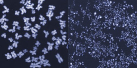ETH_en's tweet photo. #ETHZ researchers have successfully described how a #DNA-shredding #enzyme known as #MUS81 functions. #biology https://t.co/TQdkqhsvvG https://t.co/Eg2orStzdv