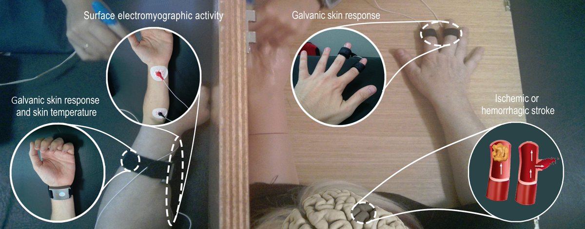 NRHB_group's tweet photo. Our first paper of the year, where we study how stroke affects embodiment, is out.  ✋🔨
https://t.co/VukUB7c4pf https://t.co/vVzy7w3S9c