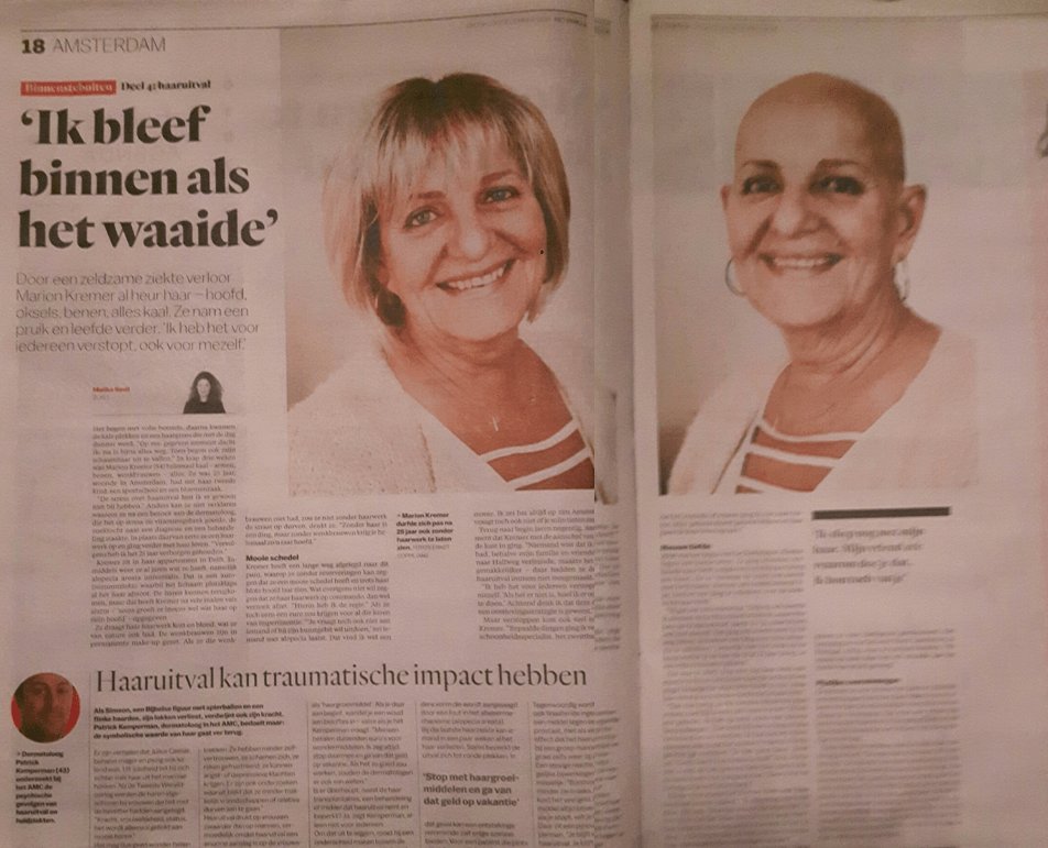MijnKaleHoofd's tweet photo. De cirkel is rond, net als mijn kale bolletje https://t.co/VhYdafxsIl https://t.co/nPRPDQM7UN