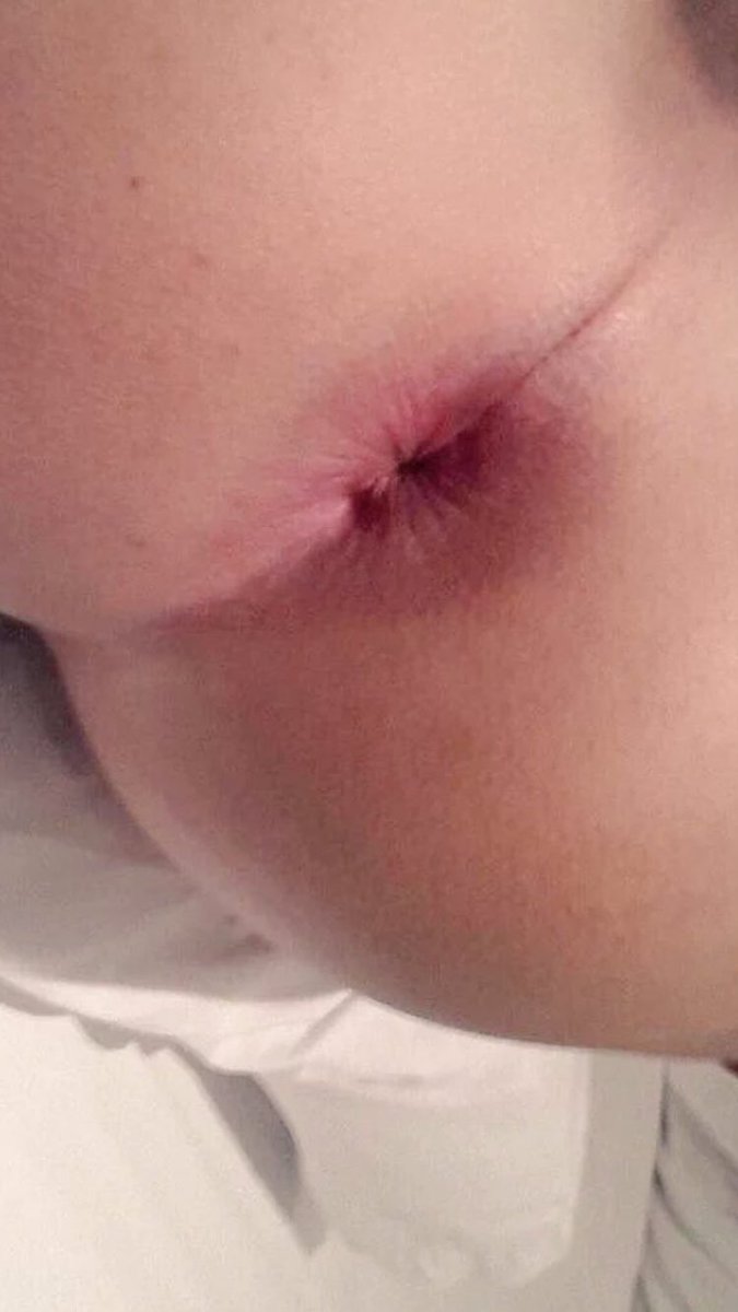 لوبي (@mop32086) on Twitter photo 