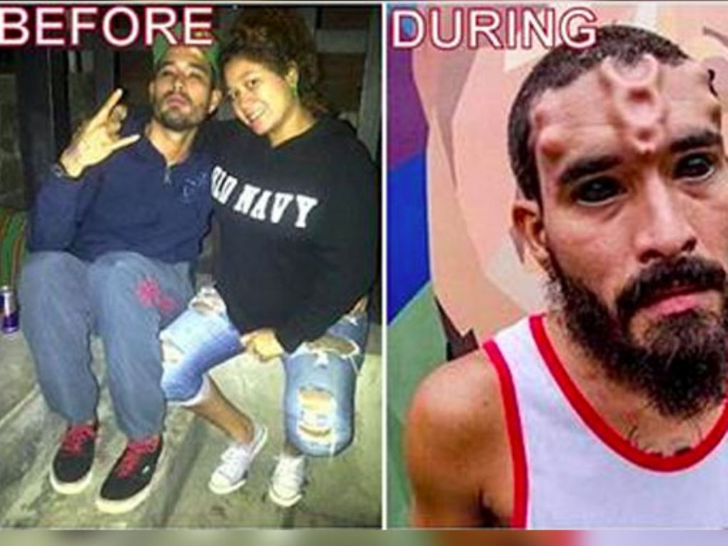 To look like Red Skull this man  has his nose removed. Now he looks like➙ bit.ly/2hsD2Dk?9673571