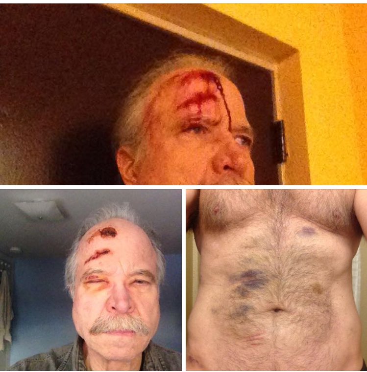 Jesus. Former Philly cop-turned-activist <a href="/CaptainRayLewis/">CaptainRayLewis</a> assaulted by Trump supporters. x.com/captainraylewi…