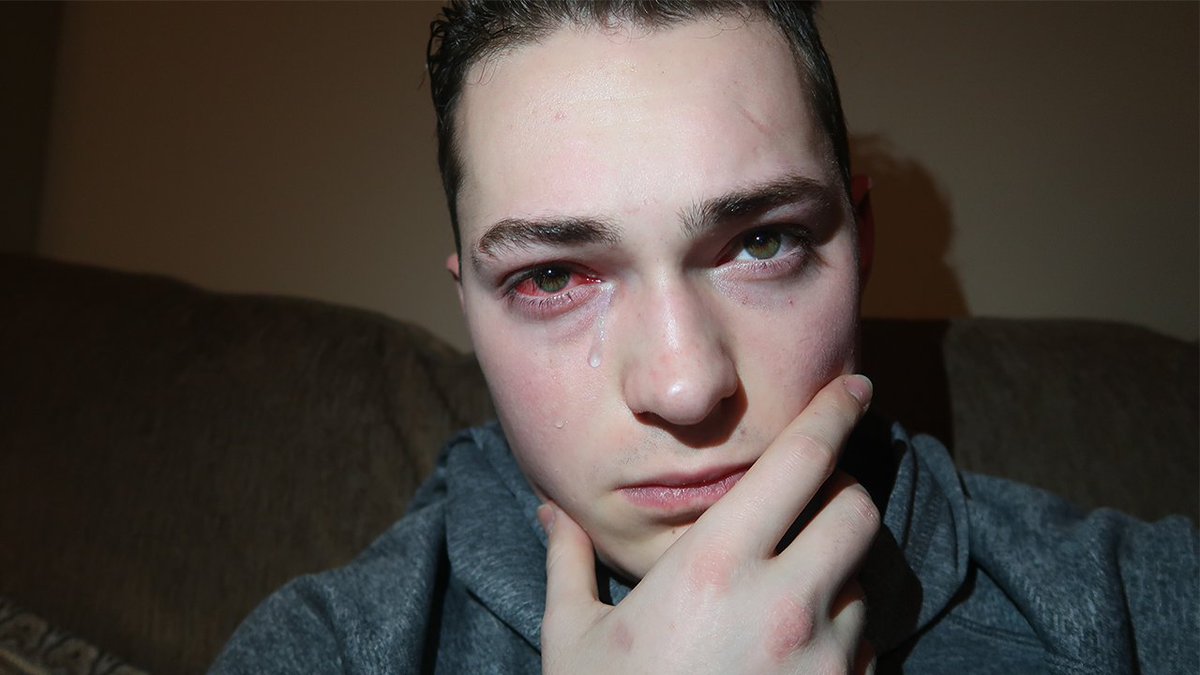 Lance Stewart tweet media