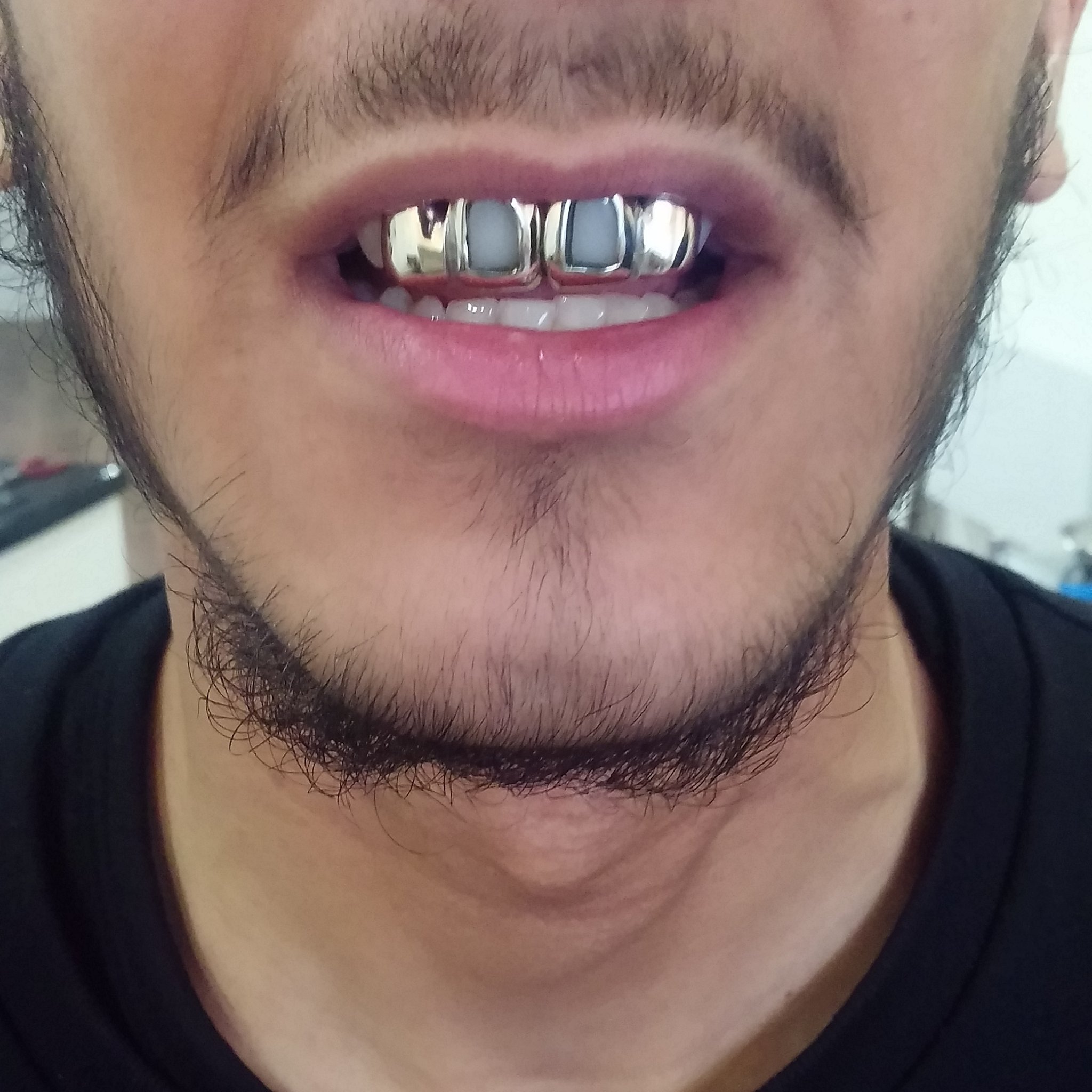 leicestergoldteeth on X