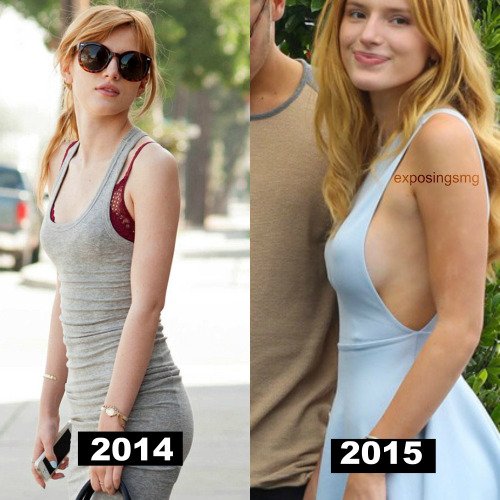 Thoughts on Bella Thorne's boob job though? 