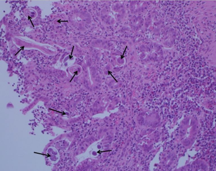 alfiaar1's tweet photo. @Konzult_ @JMGardnerMD @smlungpathguy @dr_abdulaleem
That is another one we published. #GIPath #InfectiousPath
#Pathorg #PathOrgs https://t.co/C7KGqTPouU