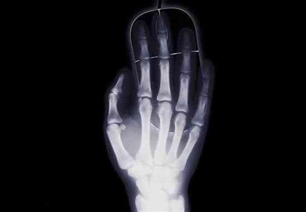 TechOutlet3D's tweet image. Russian researchers develop new method for 3D printing #biodegradable bones bit.ly/29m8Y6H #3DPrinting