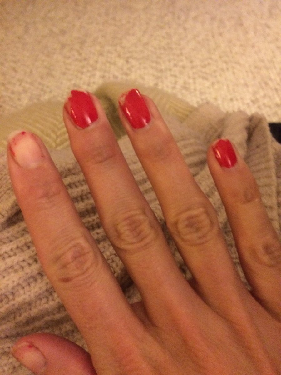 CeriChase_15's tweet photo. @SallyHansen SO disappointed with your 'Miracle Gel' varnish, advertised as lasting up to 14 days... this is after 4 days #sallyhansen https://t.co/iB1p6iwSLR