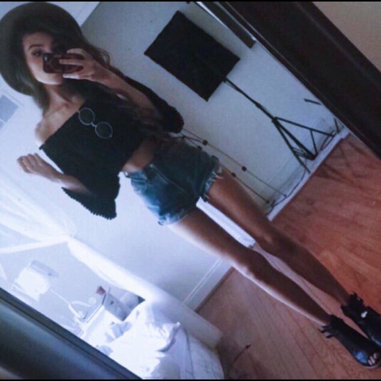 starvinganna's tweet photo. It's been a while #anorexic #legs #thinspo #bones #skinny #thin #hipbones https://t.co/4SIGwrHvnv