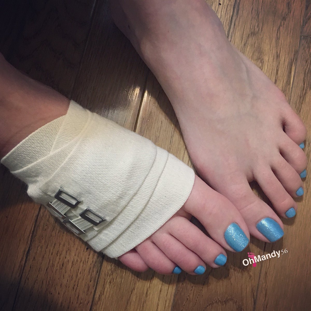 OhMandy56's tweet photo. Those cute toes are a little bit chubby after a long day. Time to take it easy. 💙 #bandagedfoot #hurtfoot #swollentoes https://t.co/BmjBufNfbv