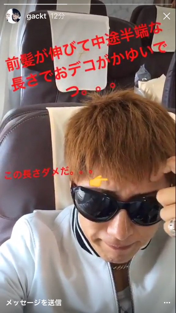 Dear Lovers Gacktさんインスタstory更新 前髪が伸びて中途半端な長さでおデコがかゆいでつ この長さダメだ T Co Fktlui1ruv Gackt 髪型 また切っちゃう予告