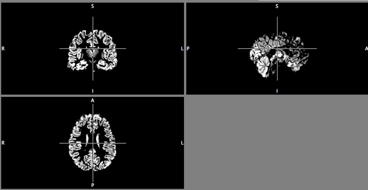 When #FSL makes life much easier! Love how it works!!! #fMRI