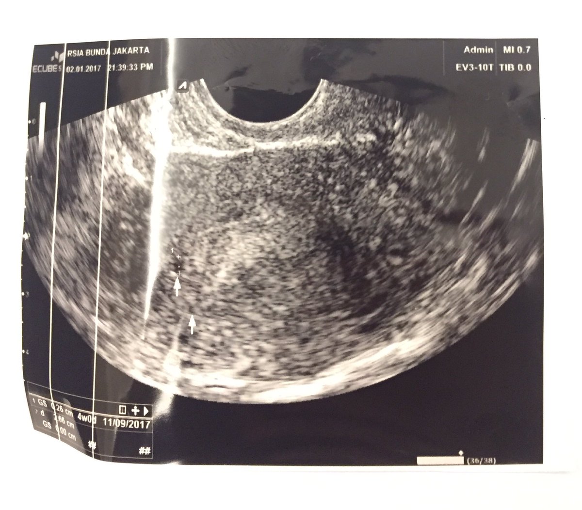 Satu titik yang jadi motivasi.. uwuwuw 😗