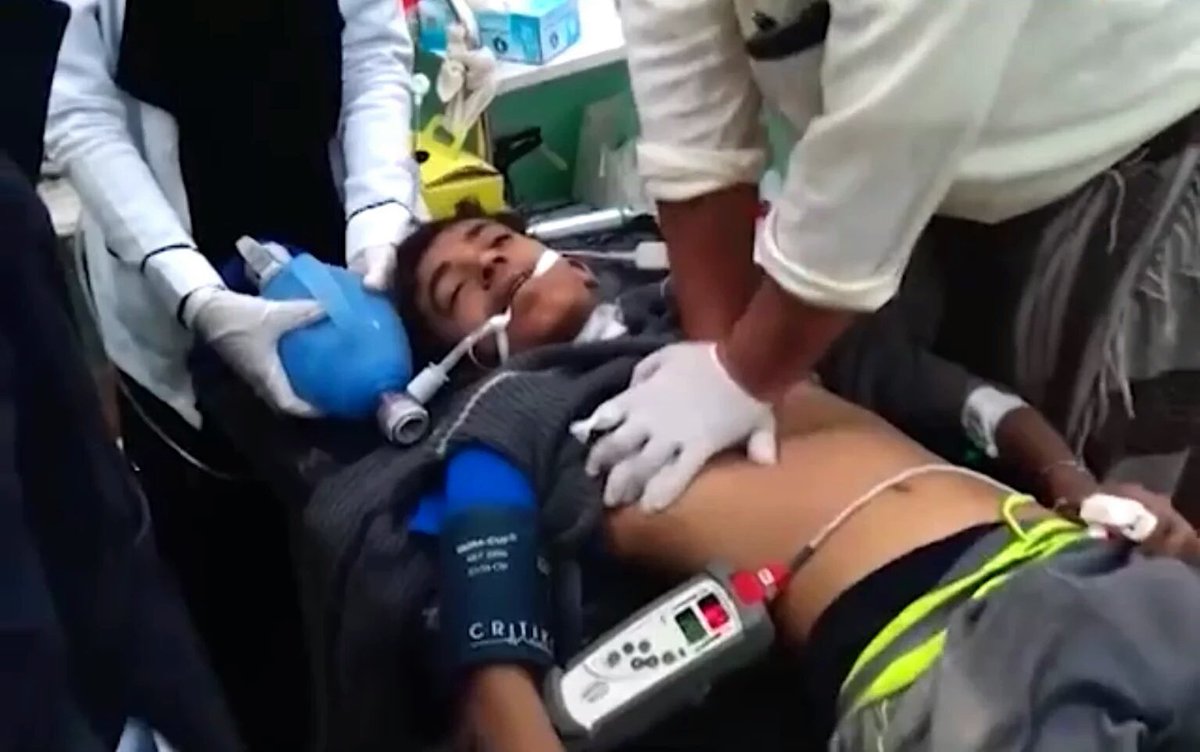 akram1_1's tweet photo. Plz share
From humanity side 
Mohammed story
A 14yrd boy in a coma now after #Saudi #UAE CO strikes n #Saada #Yemen https://t.co/1bvtQIaJ8T