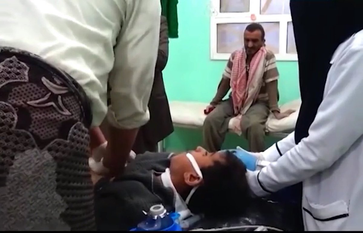 akram1_1's tweet photo. Plz share
From humanity side 
Mohammed story
A 14yrd boy in a coma now after #Saudi #UAE CO strikes n #Saada #Yemen https://t.co/1bvtQIaJ8T