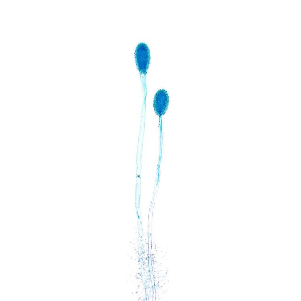 glomerulove's tweet photo. 🍄 Aspergillus clavatus 🍄 stained with #aniline #blue ... #pathology #microbiology #mycolog… https://t.co/wgIzyi17rX https://t.co/gmZ1laIWyo