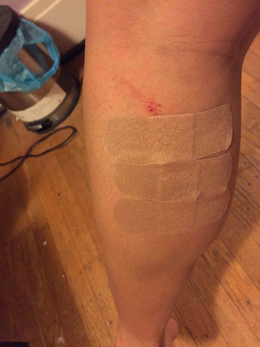 Jessshields__'s tweet photo. First razor blade cut of 2017. #beingagirlistough #3bandaidsdeep. #Deepestcutsofar #scarforlife https://t.co/EdQTmUhDER