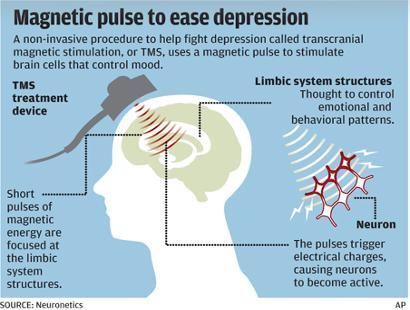 RedemptionPsych's tweet photo. Check out this infographic to learn about #TMS then contact us for even more info! https://t.co/5UzUb91SK7